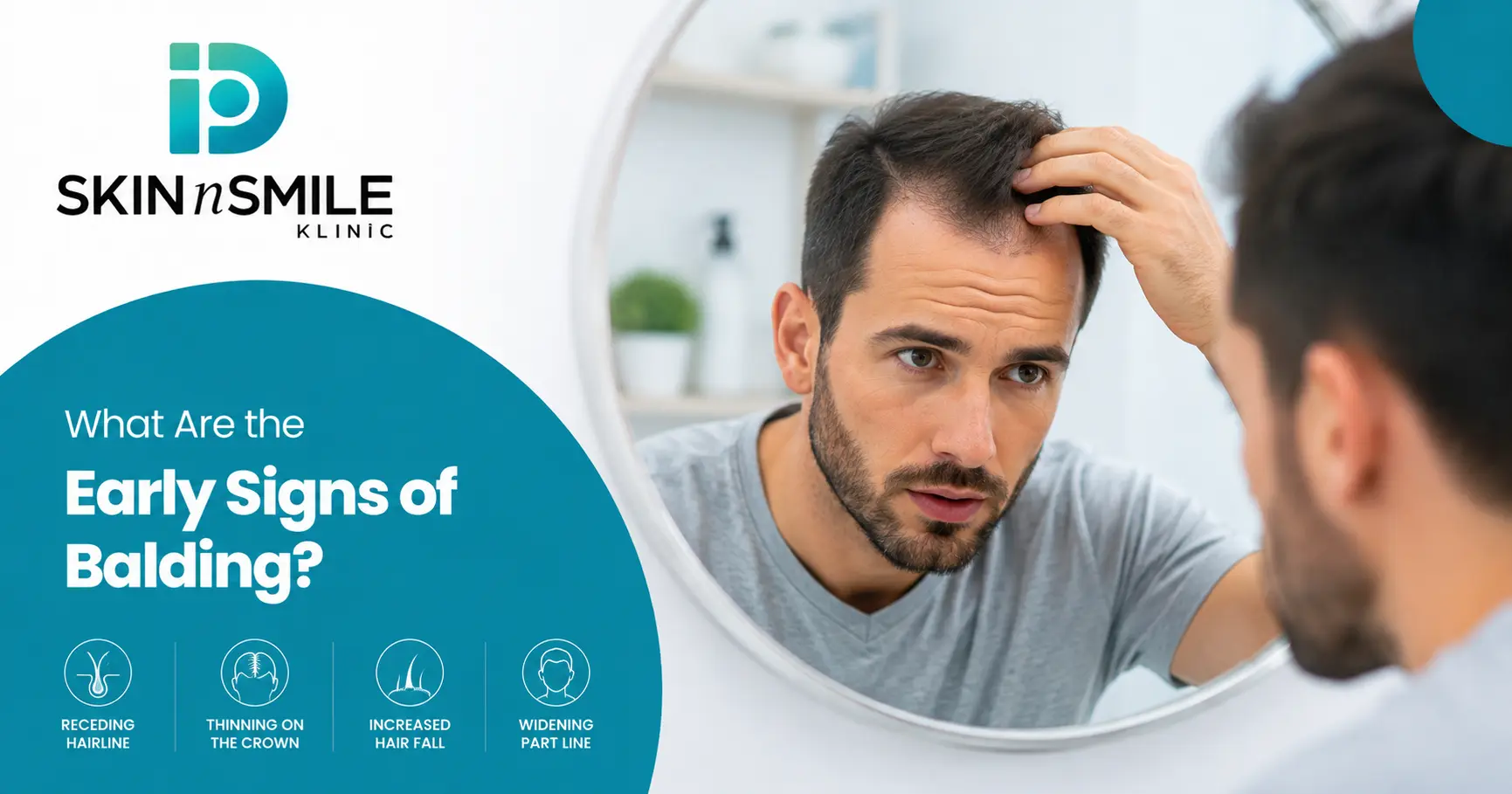 Early Signs of Balding