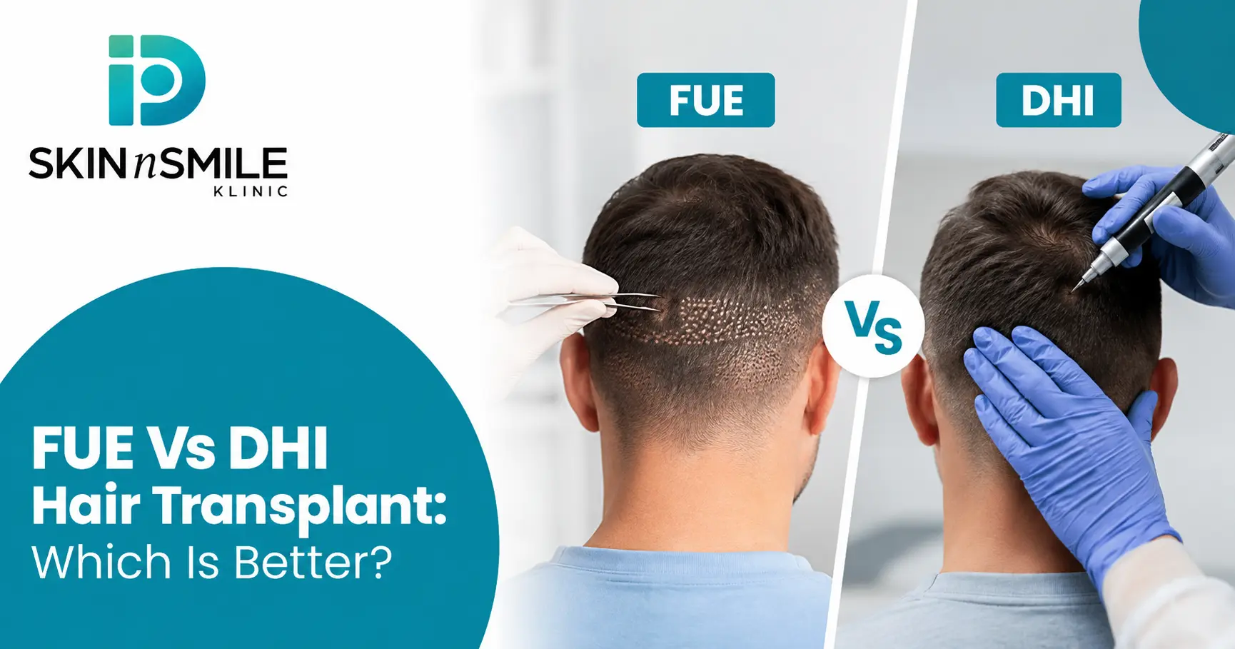 FUE vs DHI hair transplant