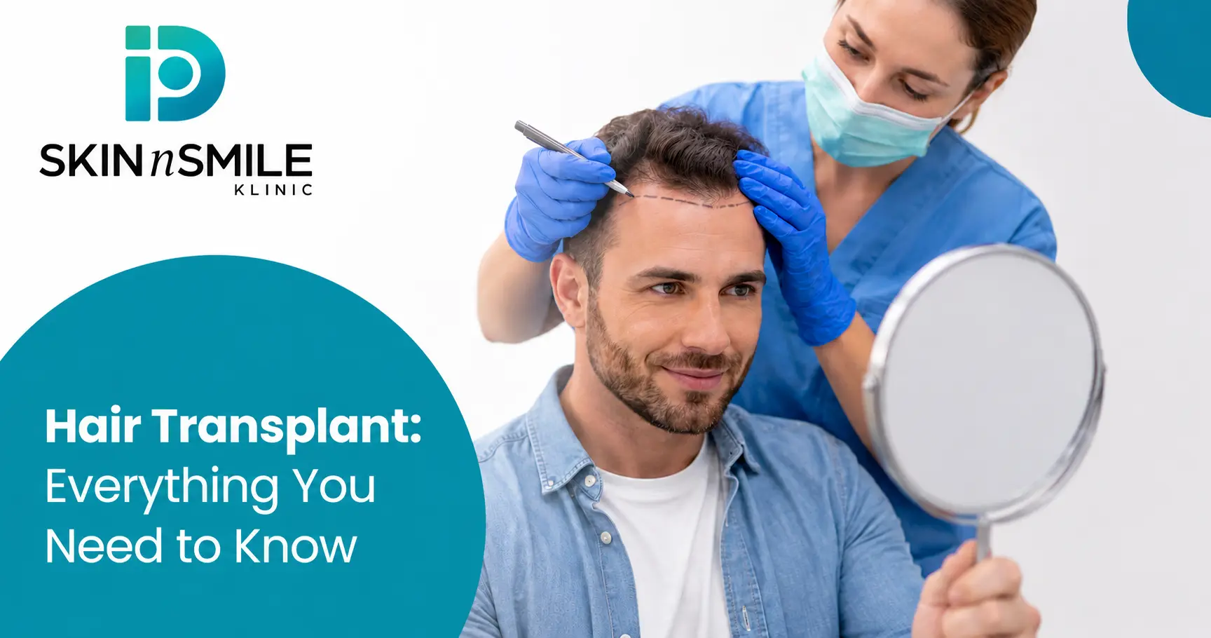 Hair Transplant in Ahmedabad