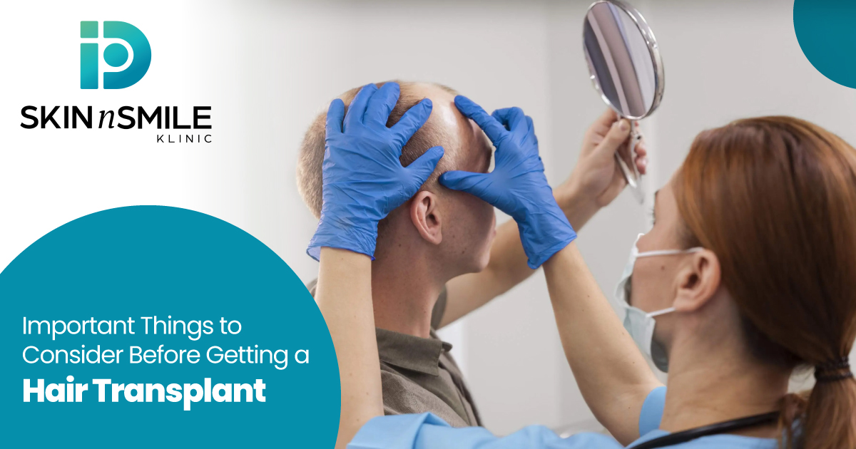 Advantages of Hair Transplant