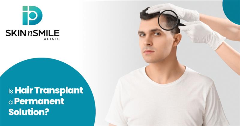 Important Things to Consider Before Getting a Hair Transplant Important Things to Consider Before Getting a Hair Transplant