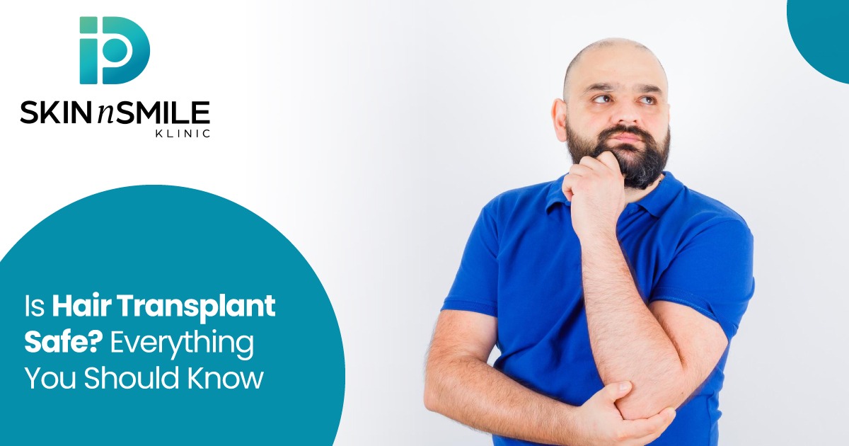 Is Hair Transplant Safe? Everything You Should Know