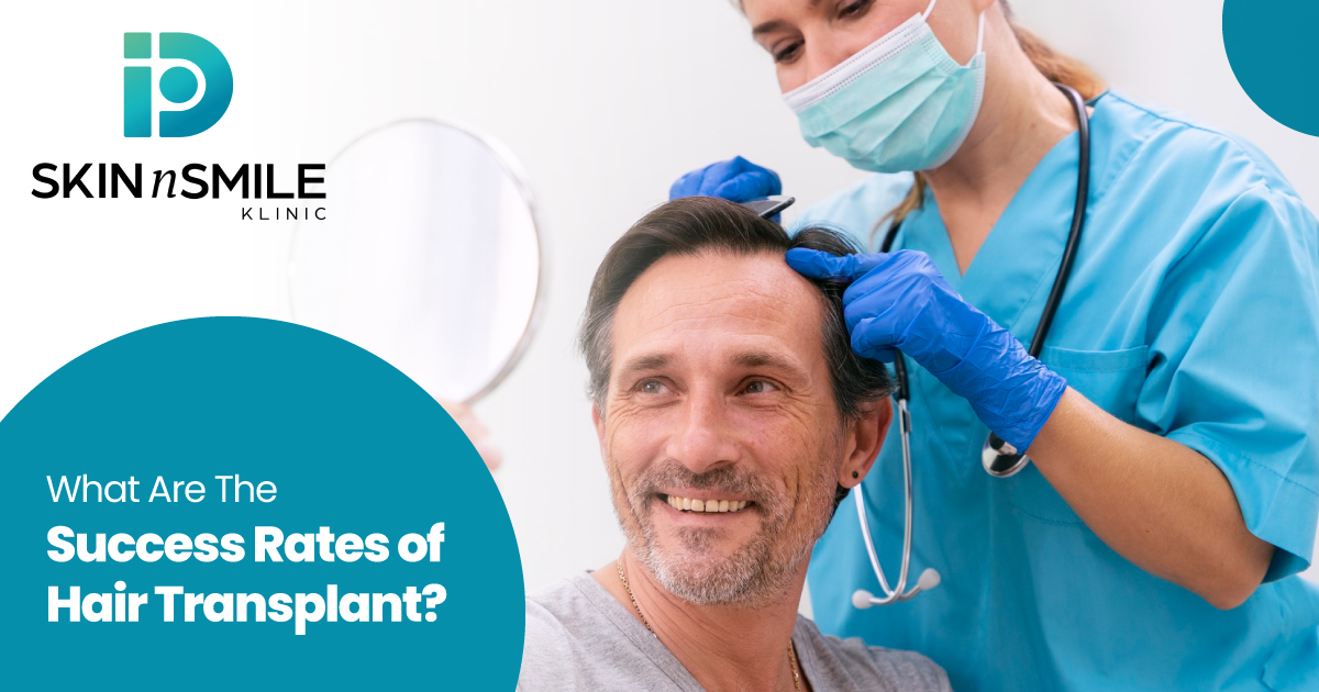 Advantages of Hair Transplant