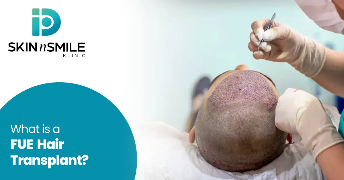 What is FUE hairtransplant What is FUE hairtransplant