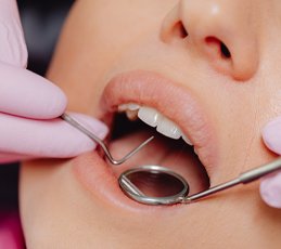 dental treatment dental treatment