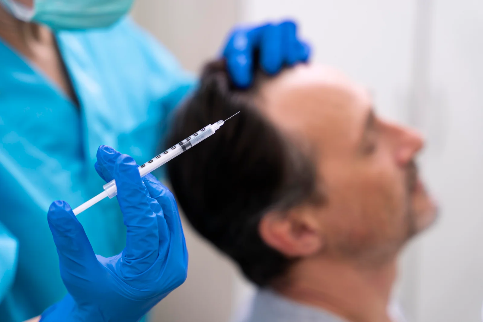 dhi hair transplant Hair Transplant By DHI Sharp Implanter in Ahmedabad