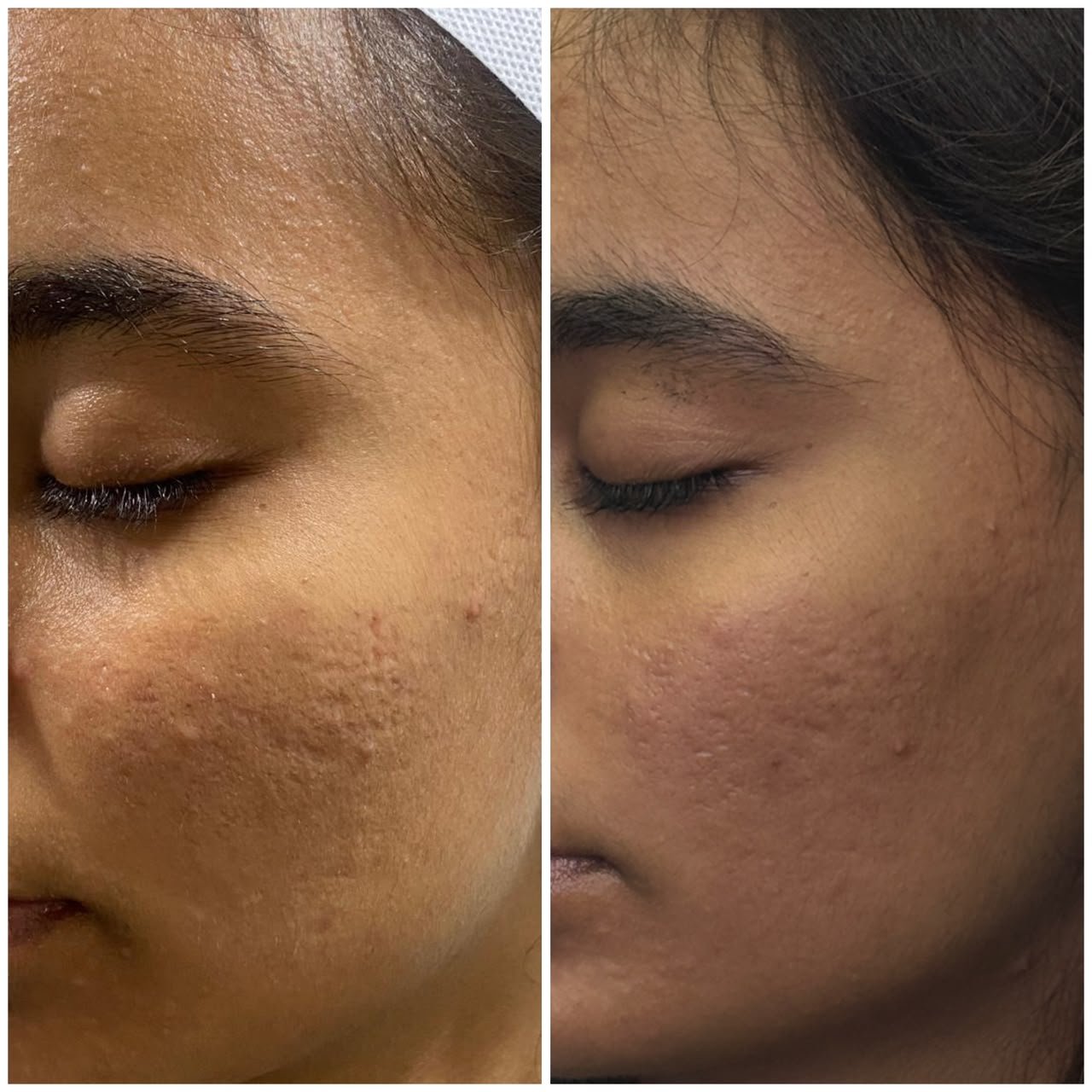 Treatment Result 2