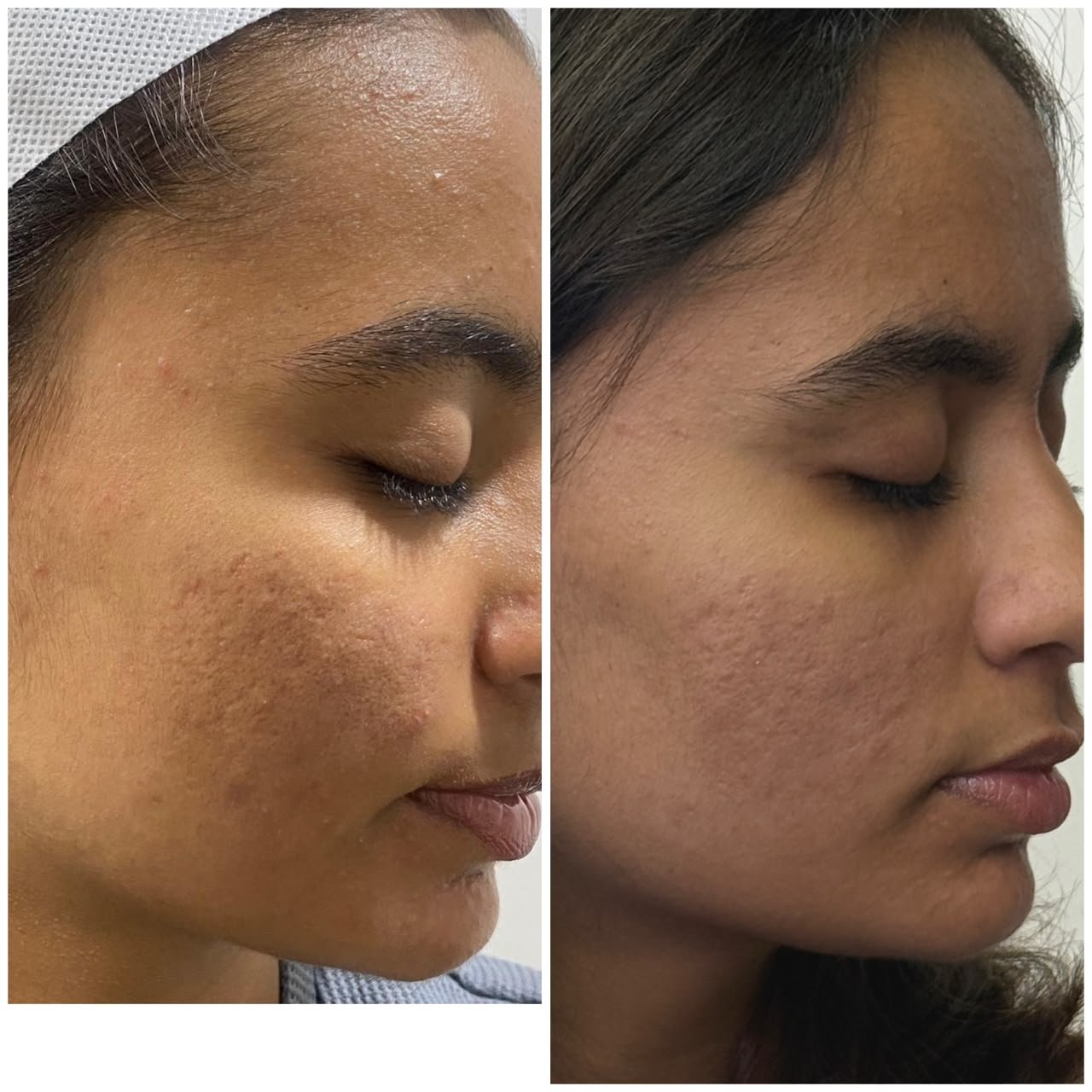 Treatment Result 3