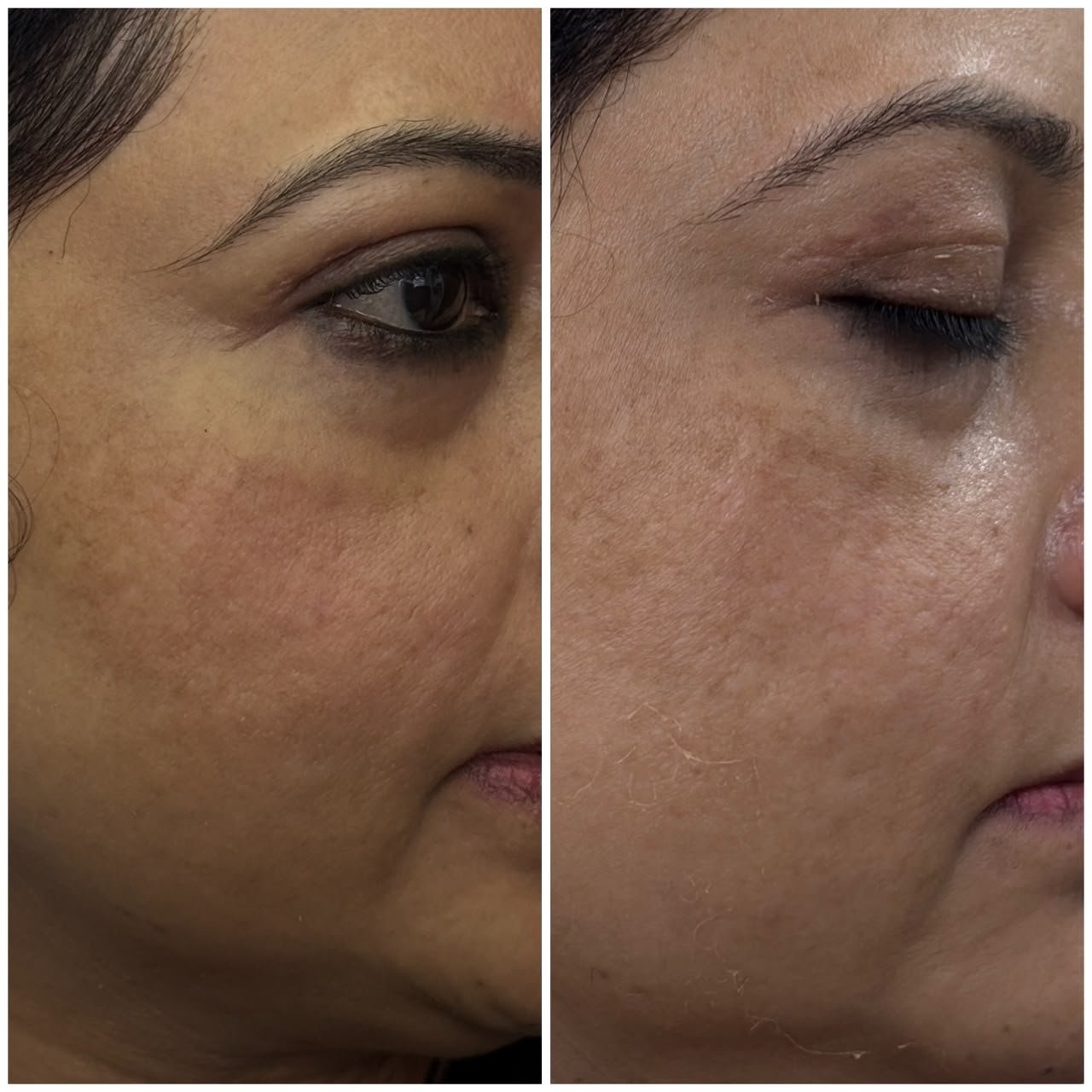 Treatment Result 4