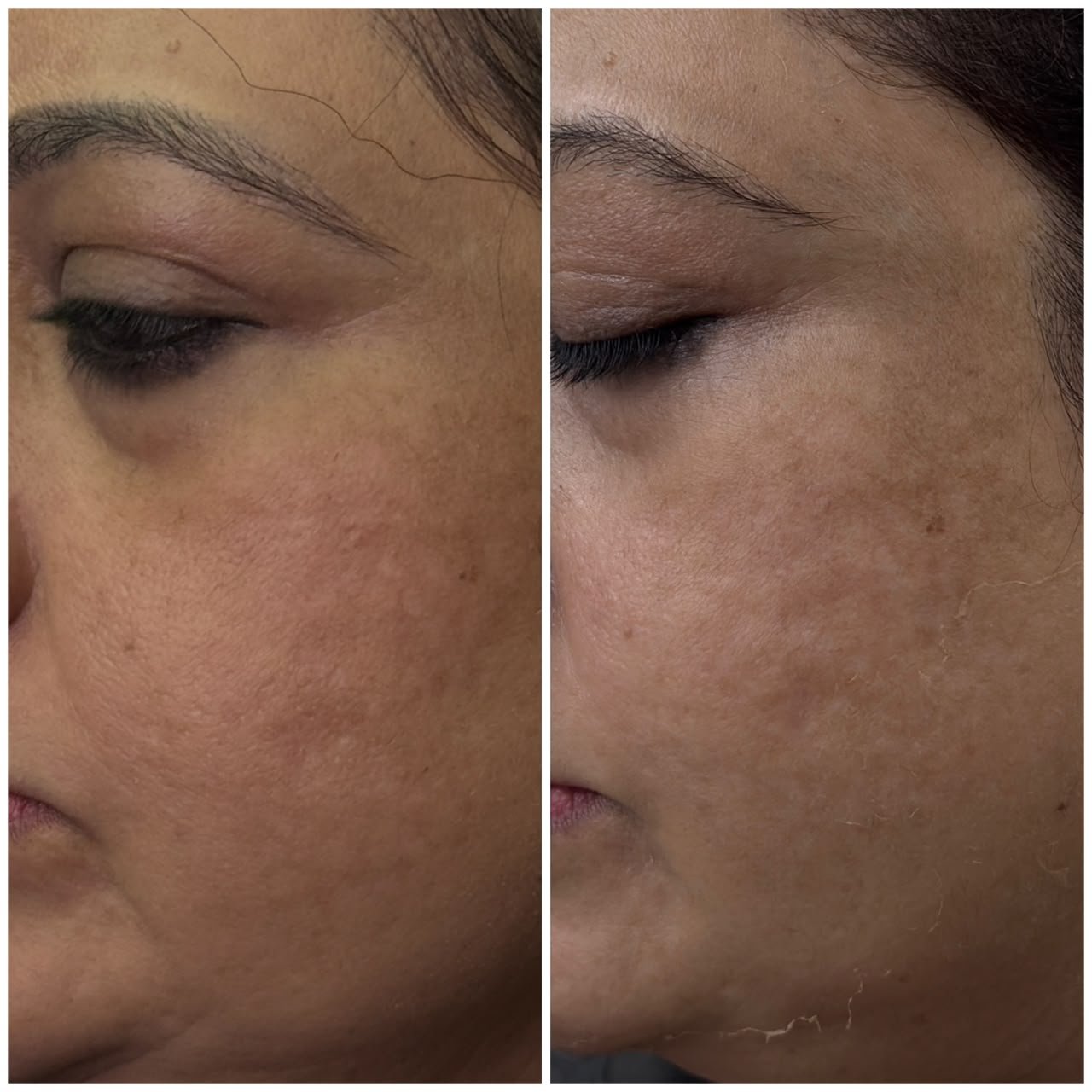 Treatment Result 5