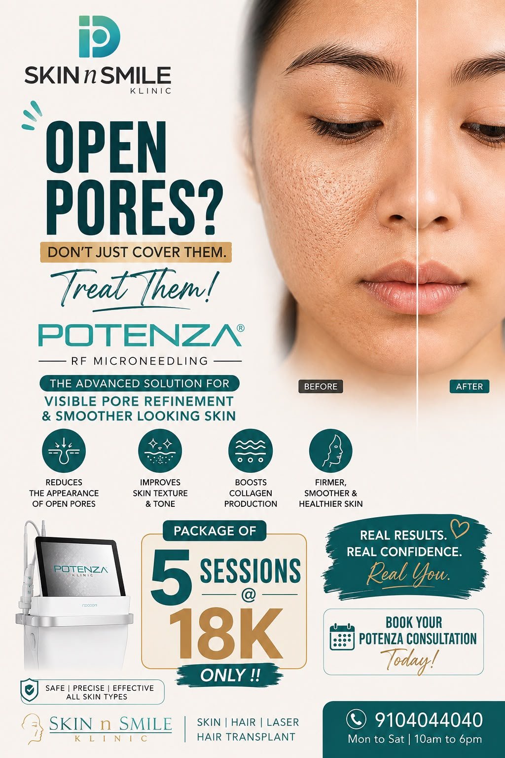 Potenza Treatment in Ahmedabad