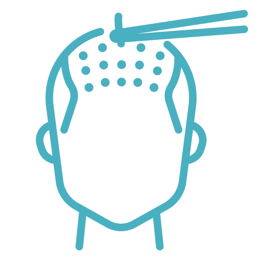 Beard Hair Transplant icon