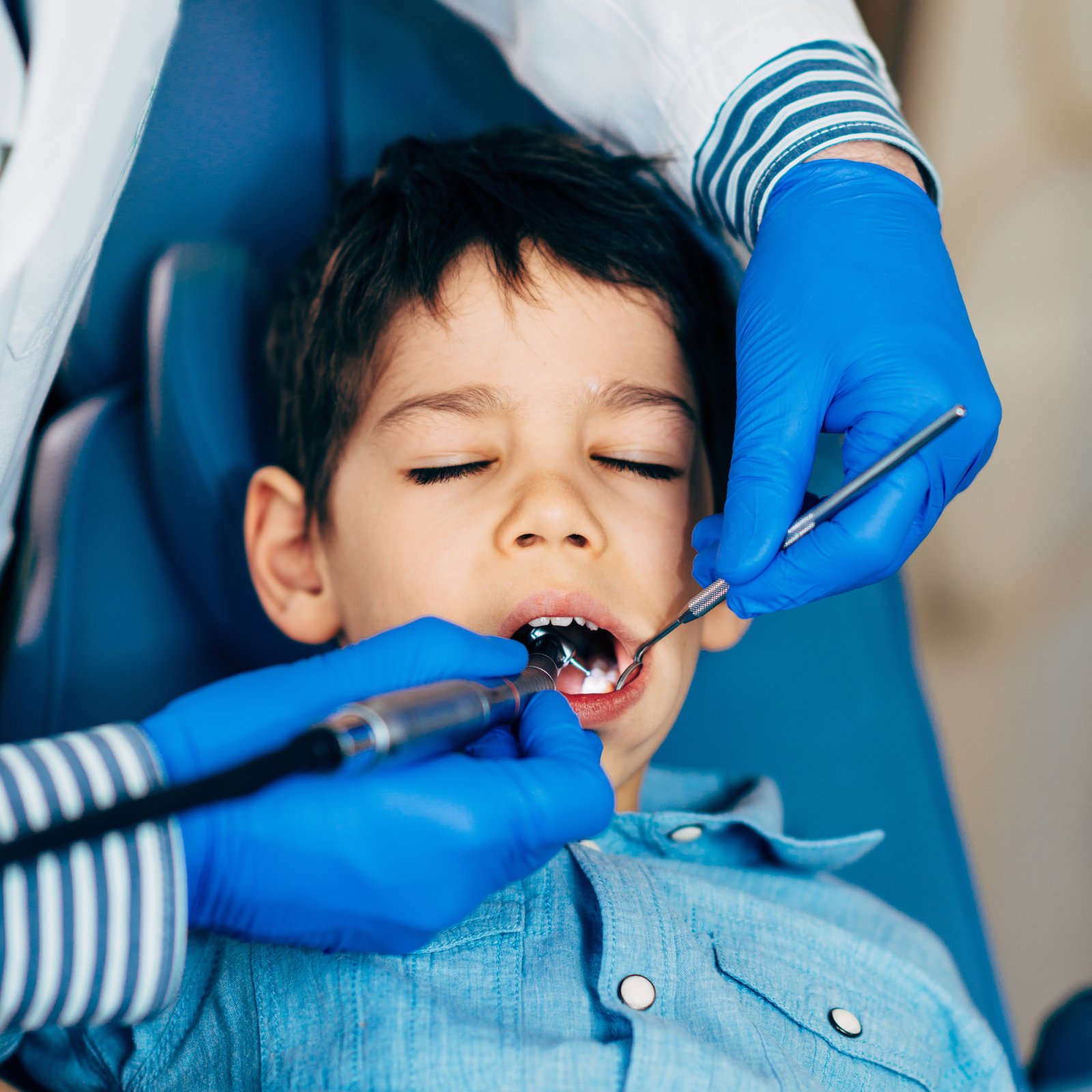 Dental Implants in Ahmedabad