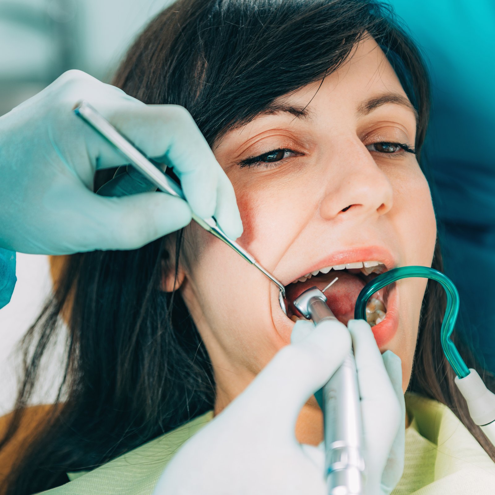 Dental Implants in Ahmedabad
